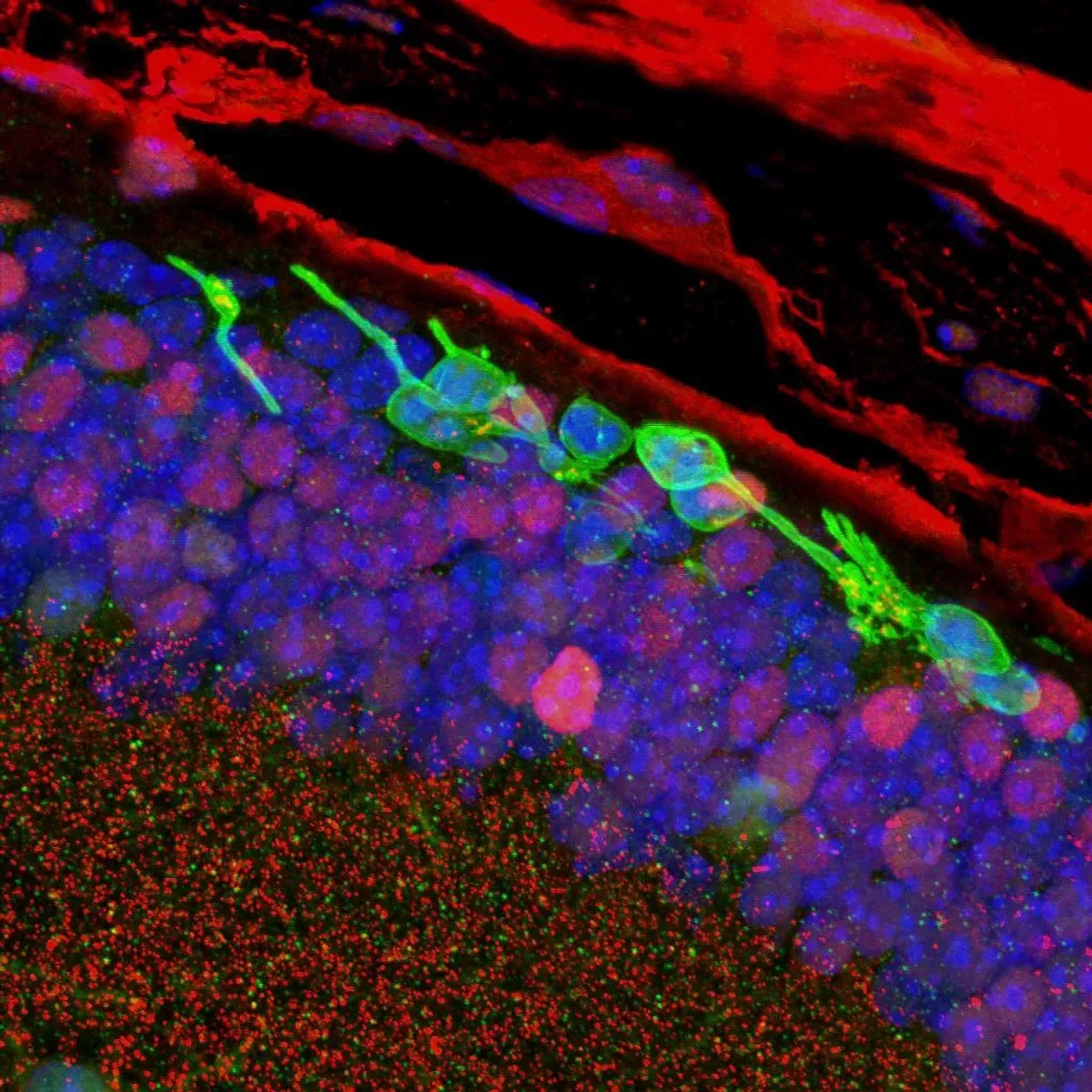 Сетчатка представляет собой сложную сеть разнообразных клеток. © Sai Chavala, M.D., CIRC Therapeutics