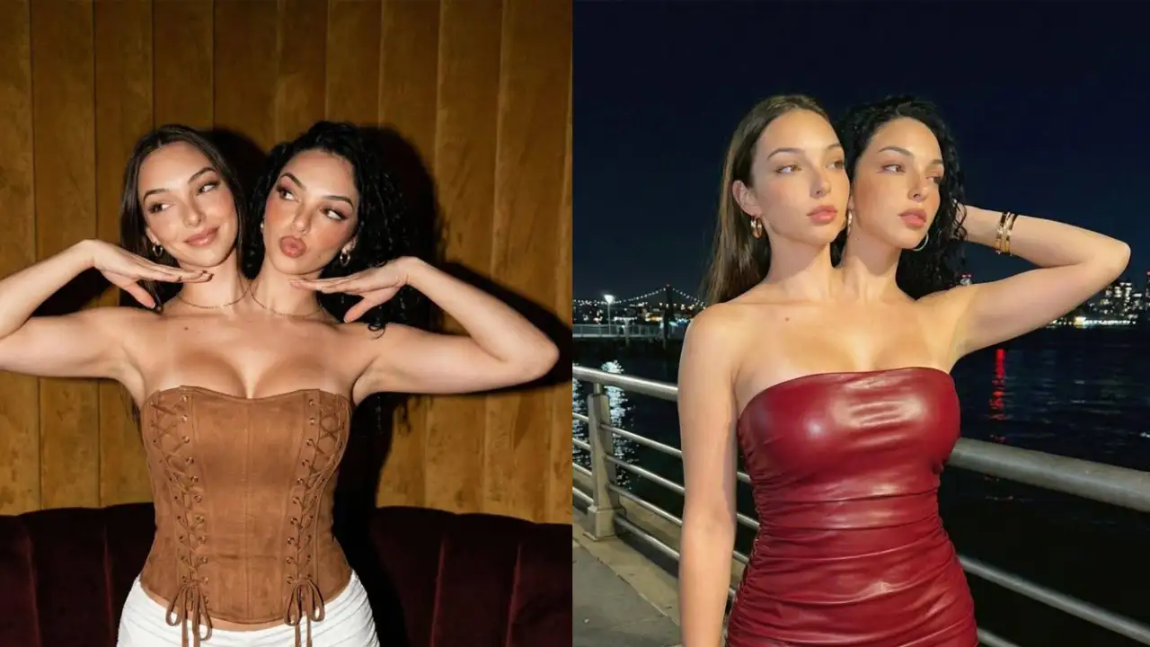 Сиамские близнецы Валерия и Камила, сгенерированные ИИ.