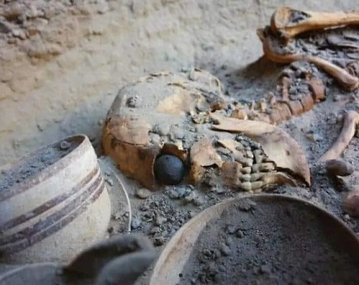 Самый ранний известный в мире глазной протез датируется 2900–2800 годами до нашей эры. Найден в Иране.