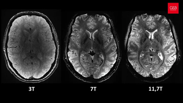 Снимки человеческого мозга, полученные с помощью нового МРТ-аппарата Iseult при различных уровнях мощности – 3 Тл, 7 Тл и 11,7 Тл. 