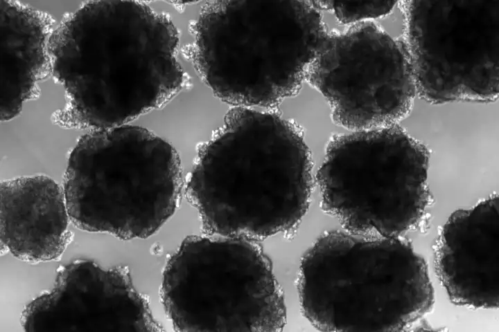 Неандертальские органоиды под воздействием свинца.