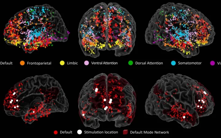 Электроды в нескольких областях мозга показывают активность мозга в реальном времени. Цветные точки показывают расположение всех электродов у всех пациентов, с цветовой кодировкой по областям мозга. Красные точки на нижних изображениях показывают расположение электродов в DMN.