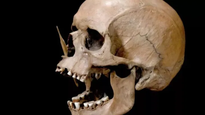 Это череп обитателя Скандинавии, который был убит двумя точными стрелами.
