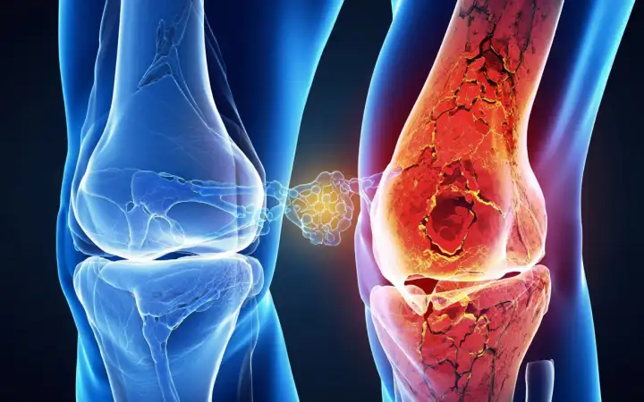 Коленные суставы.