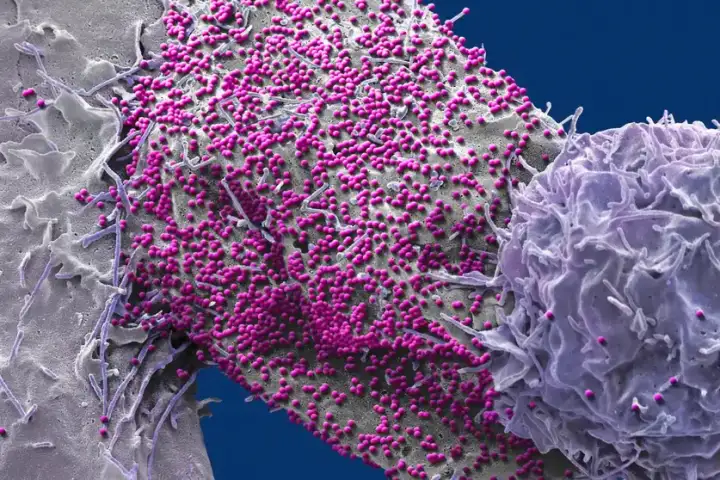 ВИЧ-инфицированная человеческая клетка. ВИЧ-инфицированная человеческая клетка.