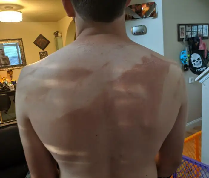 «Упрямый муж сказал, что ему не нужна моя помощь в нанесении солнцезащитного крема на спину».