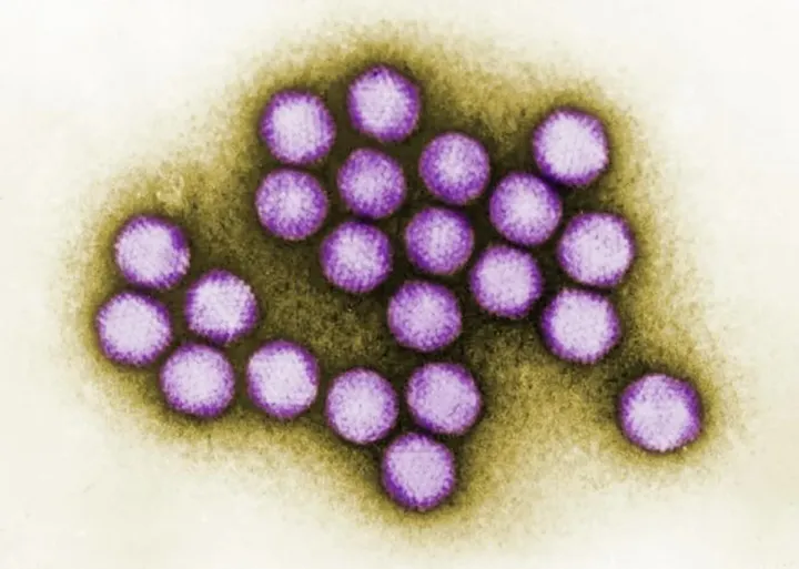 Аденовирус — один из трех вирусов, выделенных из останков неандертальцев.