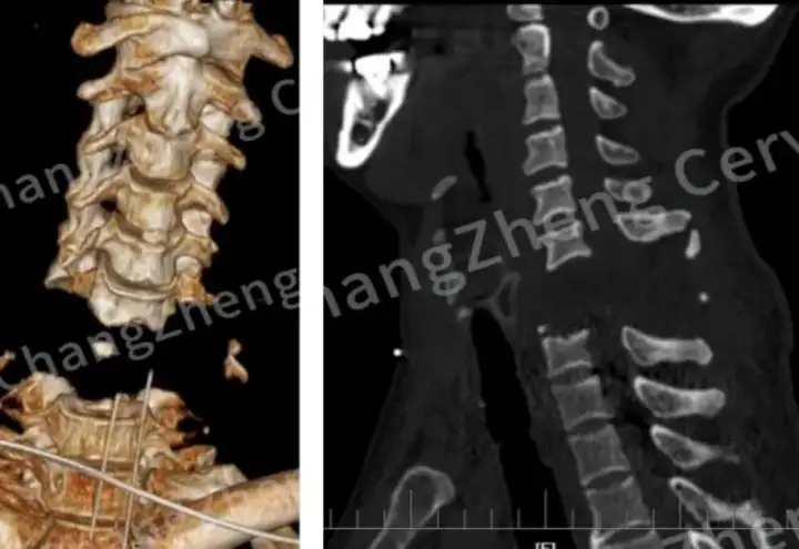 Повреждения пациента.