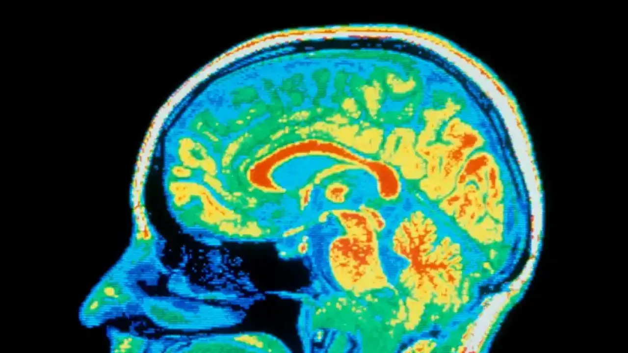 Головной мозг.