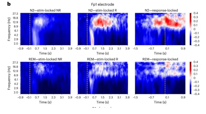 Электроды зафиксировали реакцию на задачу во время сна.