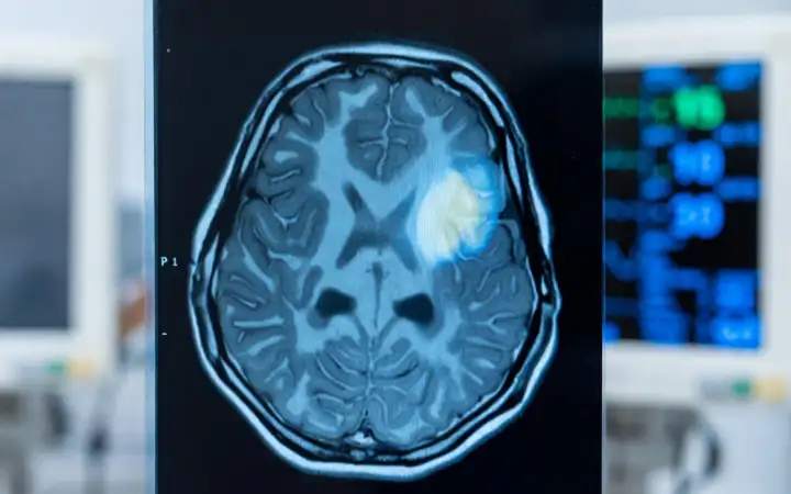 Скан мозга. Скан мозга.