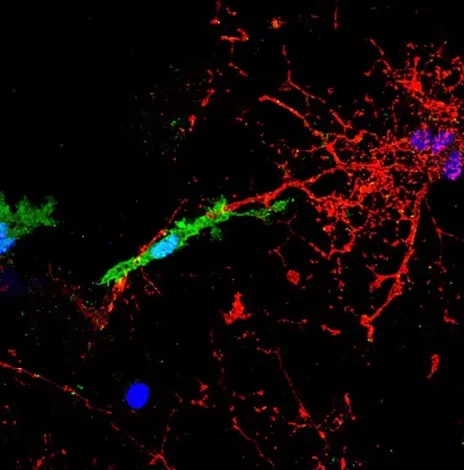 Микроглиальная клетка (зелёная) контактирует с отростком нервной системы аксоном (красный). В присутствии HERV это приводит к повреждению аксонов.