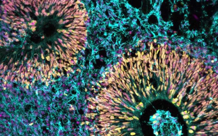 Органоид человеческого мозга, показывающий различные типы клеток по цвету: ядра (пурпурный), клетки-предшественники (желтые), новорожденные нейроны (синие).
