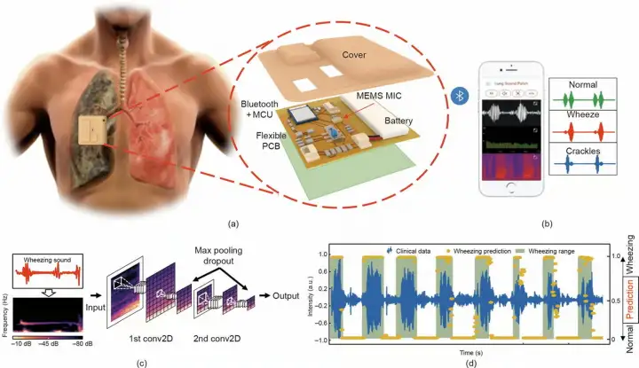 Принцип работы электронного стетоскопа.