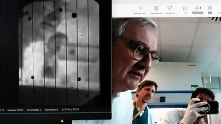 Изображение слева показывает экран ноутбука, на котором в реальном времени отображается видеосигнал с сетчатки донорского глаза.