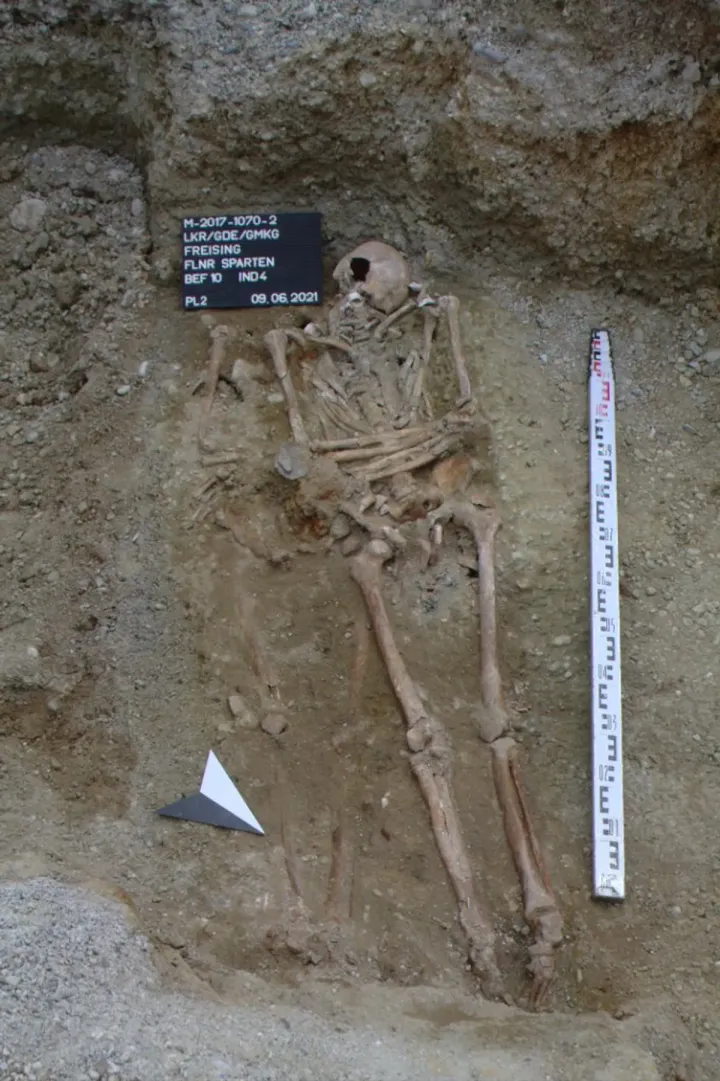 Скелетные останки владельца протеза, обнаруженного близ приходской церкви Св. Георгия. 