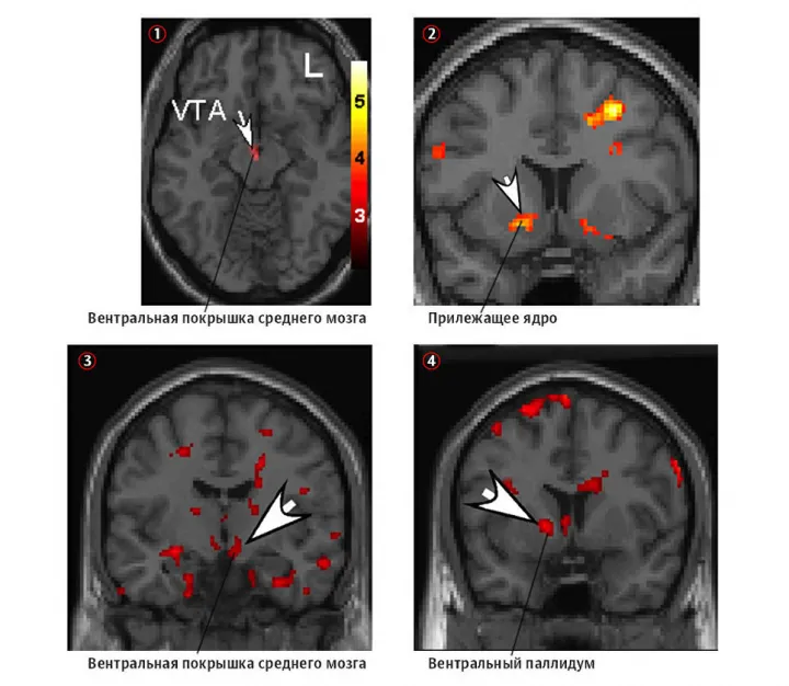 Сканы фМРТ, показывающие, как выглядит мозг любящих людей.