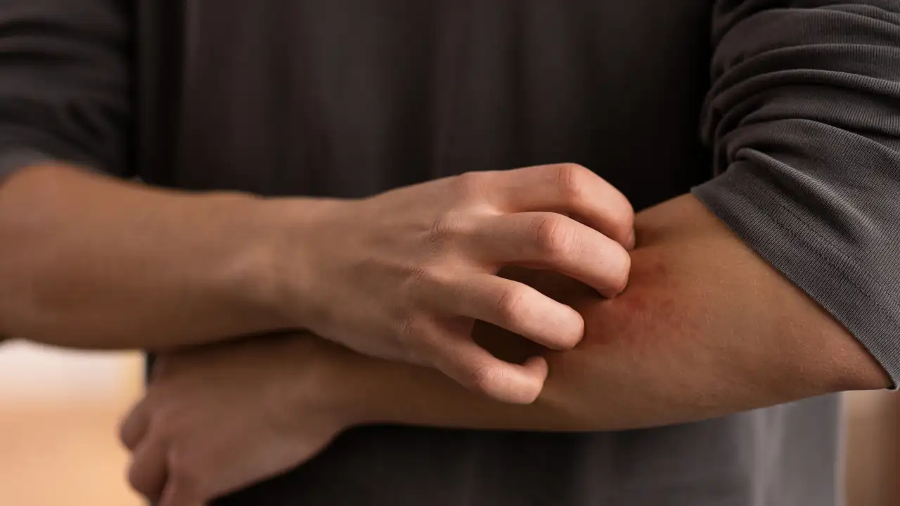 Проблемы с кожей.