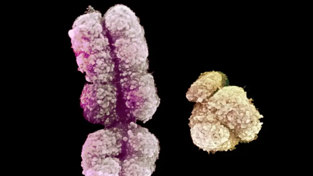Х и Y (справа) хромосомы.